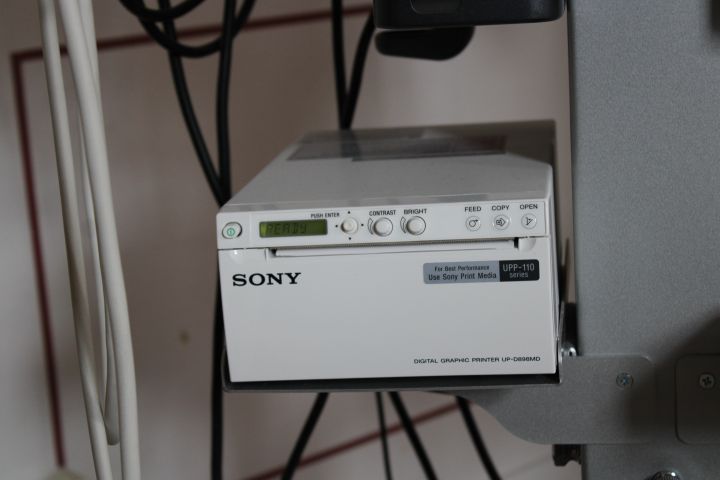 718798-10 Ultrasonic machine, Alpinion Ecube i7