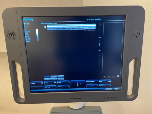 960775-2 Mind Ray DC-N3 Ultrasound machine / ultrasound device