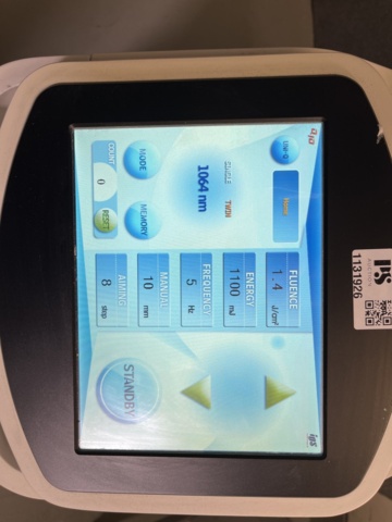 1131926-11 IDS, Q-switched ND:YAG Laser Q10 -2022